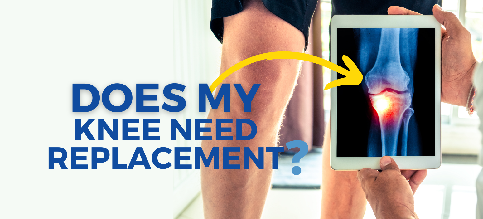 Does my knee need replacement?