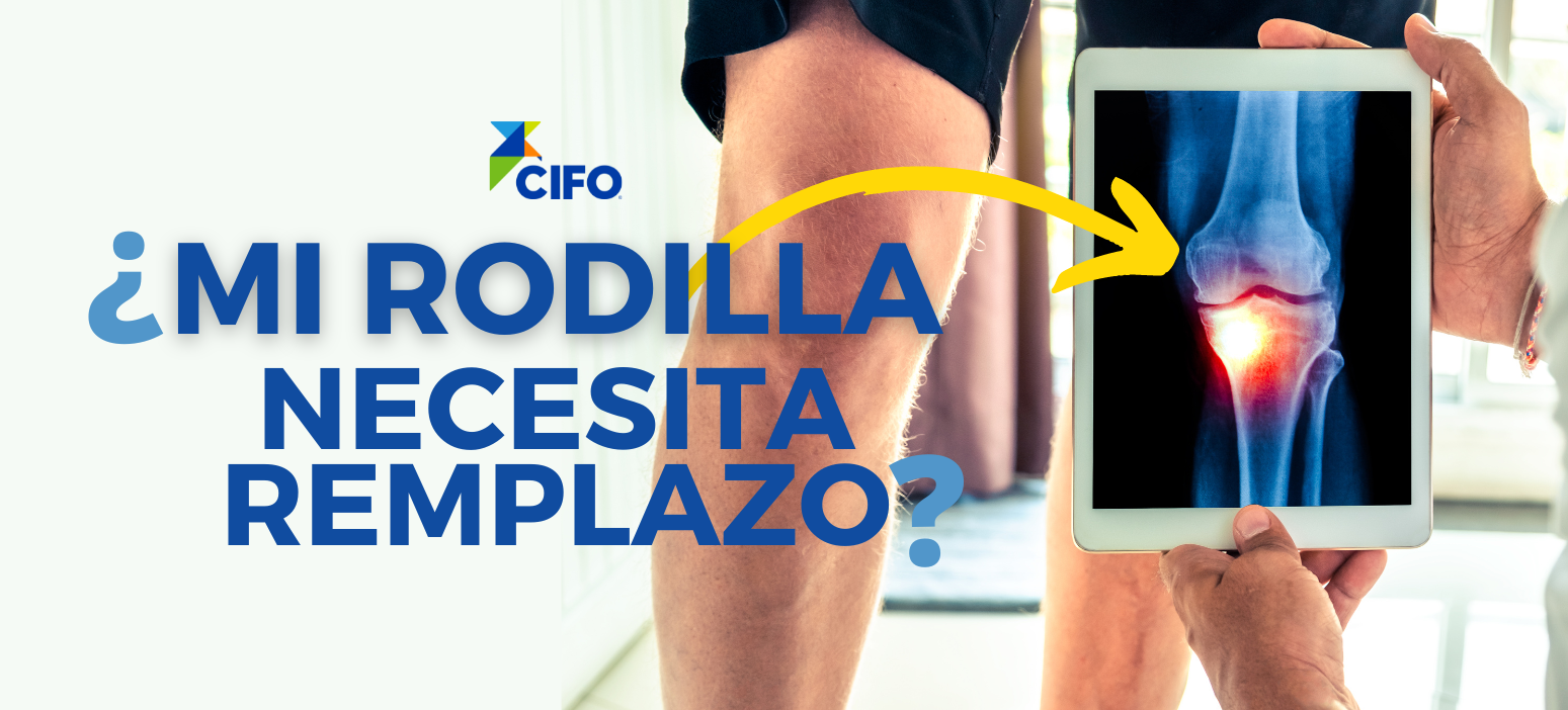 ¿Mi rodilla necesita remplazo?
